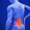 Thoái hóa đốt sống thắt lưng – Nguy cơ bại liệt nếu coi thường